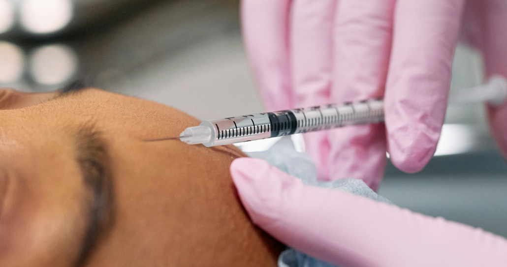 Botox for Chronic Migraine Prevention