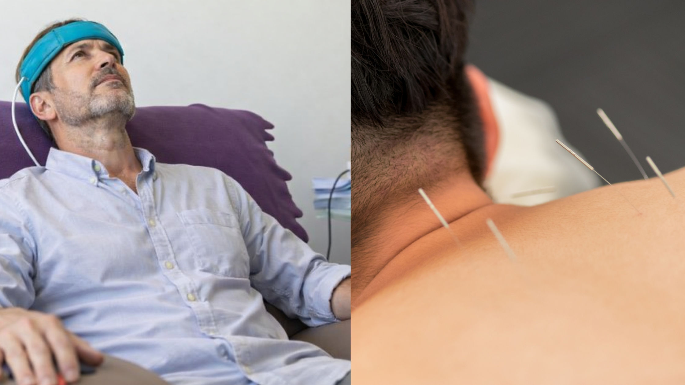 Non-Drug Migraine Treatments: Acupuncture, Biofeedback, and Lifestyle Strategies